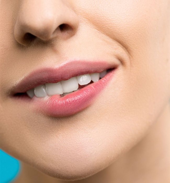 Faccette dentali 2 Faccette dentali