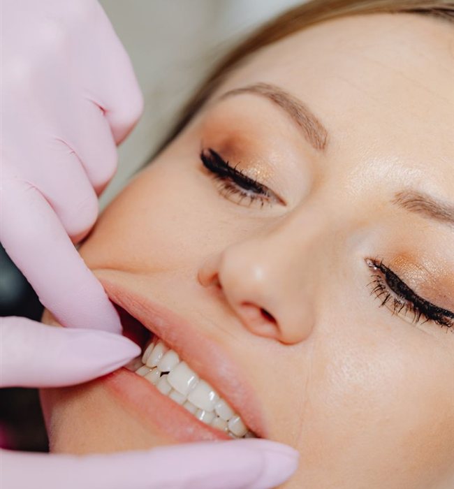 Faccette dentali 5 Faccette dentali