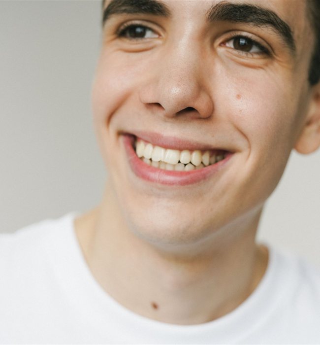 Gummy smile 1 Gummy smile