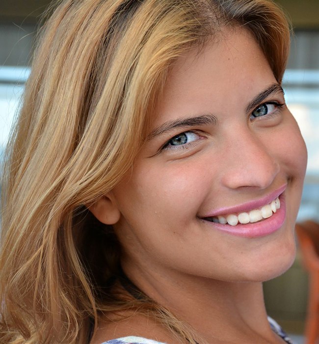 Sbiancamento dentale 5 Sbiancamento dentale denti bianchi